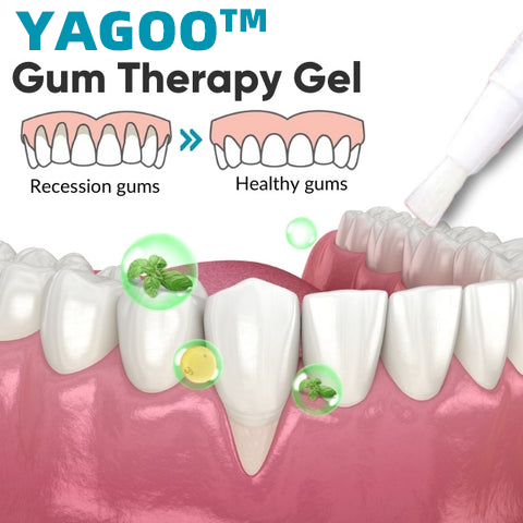 （🔥LAST DAY SALE-80% OFF) Yagoo™ Gum Therapy Gel