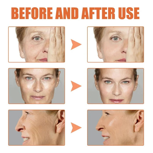 💯Last Day Promotion 70% OFF💯-Tiworld™ Botox Facial Essence