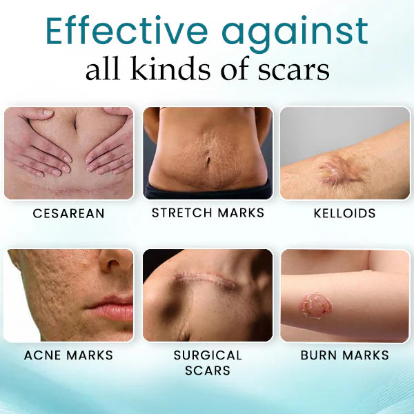 SEAGRIL™ Advanced Scar Care Formula