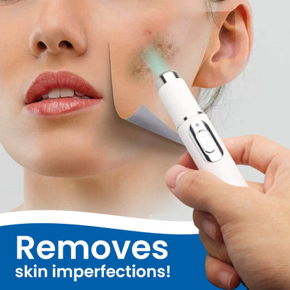 Yagoo™ Blue Light Skin Spot Remover - 👩‍⚕️ Recommended by Experts! 🔥 80% Limited Discounts! 💰