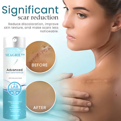 SEAGRIL™ Advanced Scar Care Formula